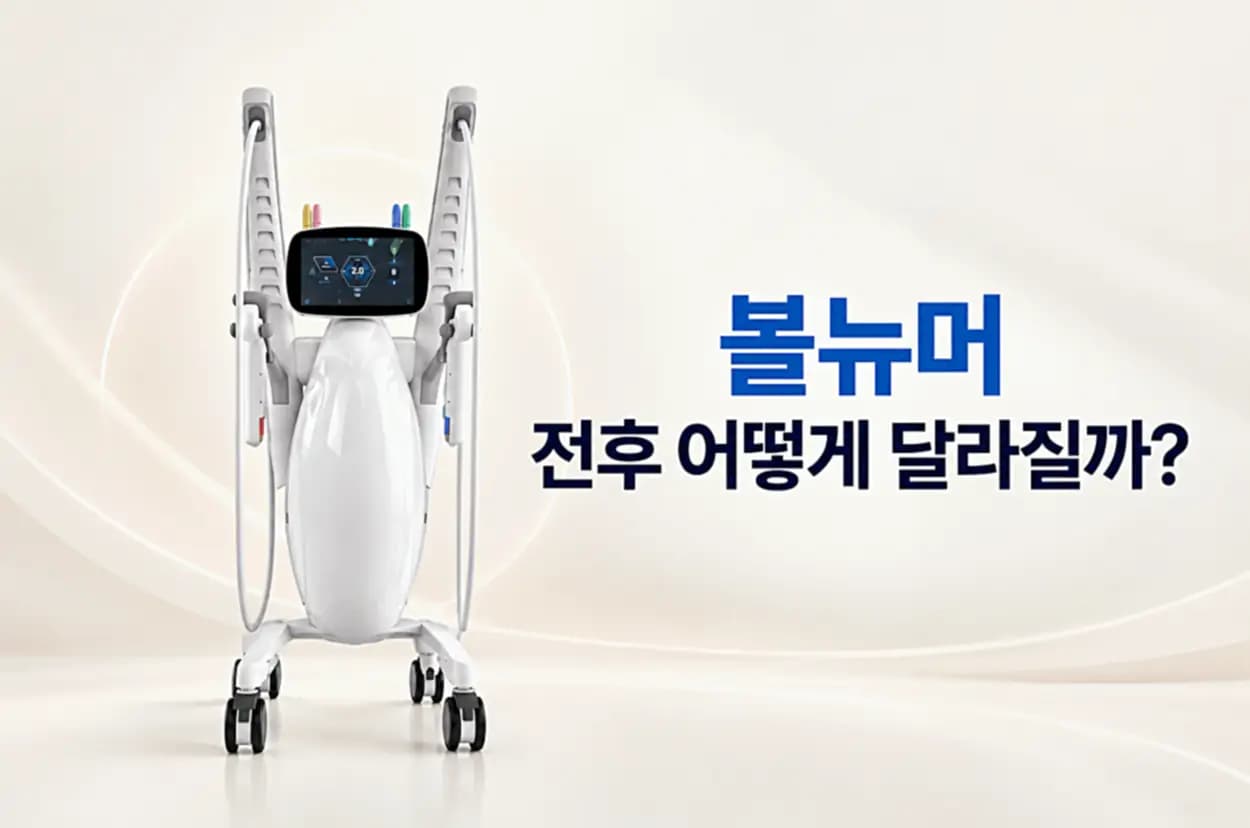 볼뉴머 전후 피부 탄력과 턱선 변화에 대한 설명을 담은 볼뉴머 고주파 리프팅 장비 이미지